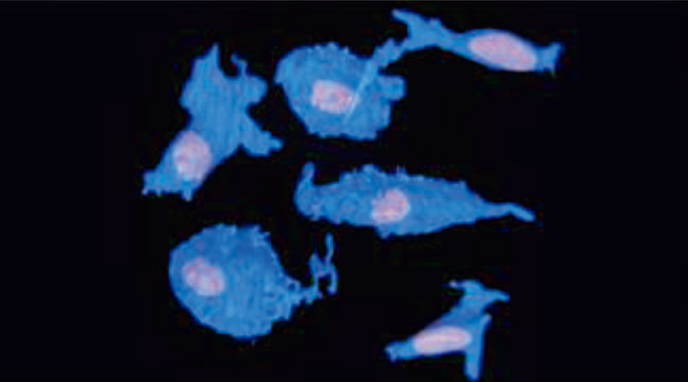 線維芽細胞が孤立化した状態の資料画像