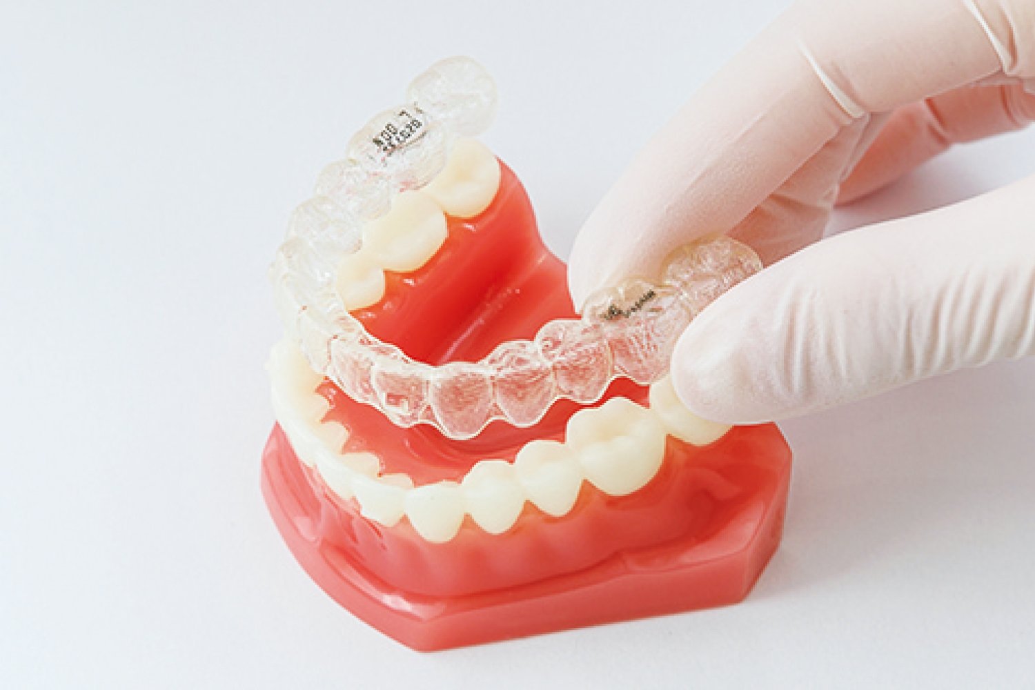 歯列矯正はインビザライン（マウスピース）、ワイヤー、裏側矯正から選べます
