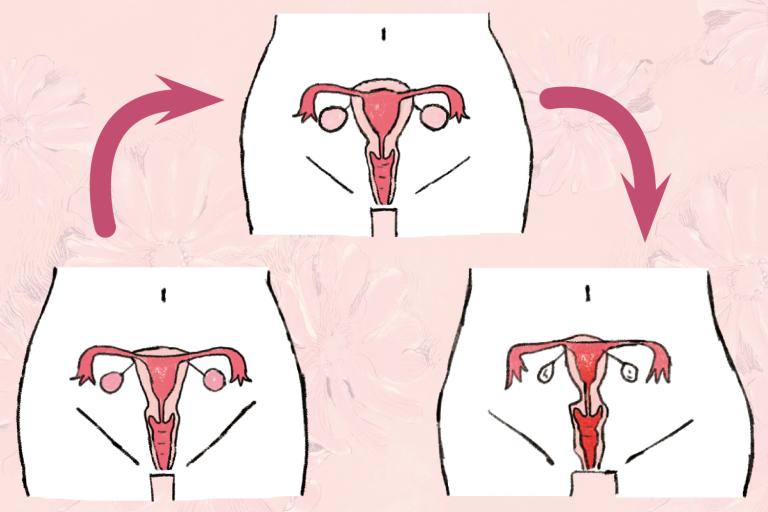 閉経前後、子宮や卵巣の見た目も顔と同じように老化します／婦人科医が解説