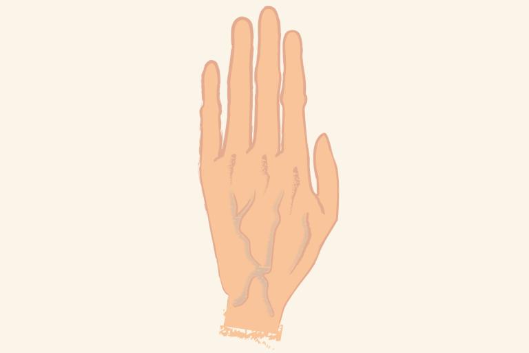 手の甲の血管浮きが気になる。原因は？ レーザー治療で改善する？／手が老けて見える原因と改善法＜4＞
