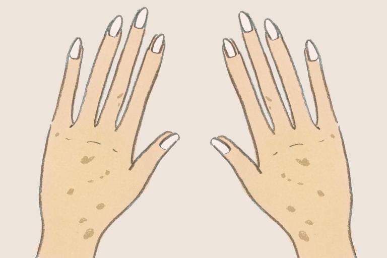 手の「シミ＆くすみ」対策は日々のUVケアと週1回の角質ケアを／爪と手のコツコツお手入れ