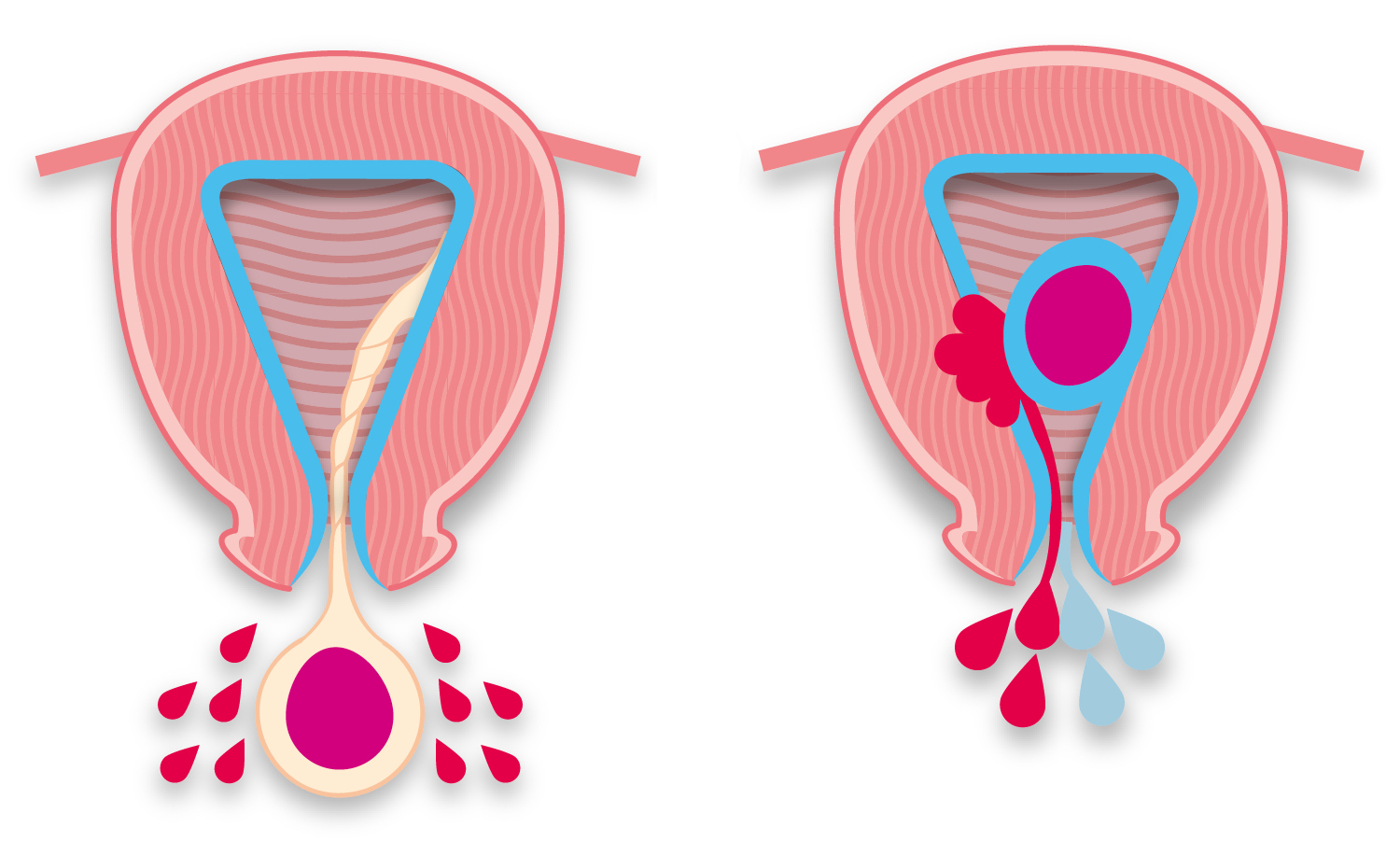 違いを見分ける方法