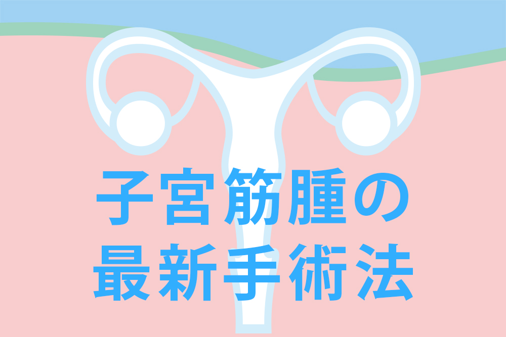 【子宮筋腫の手術法】お腹を切る？切らない？ 全摘する？ 妊娠を望む？ 自分にとっての最良なもの見つけてください