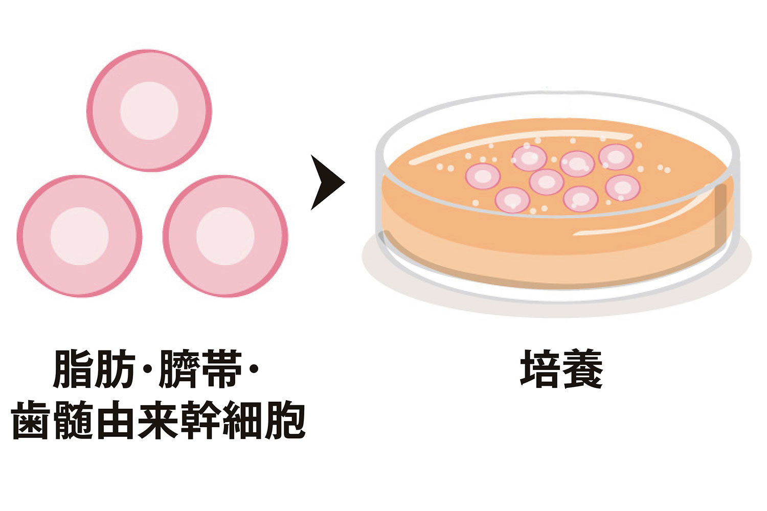 すでにはじまっている幹細胞による病気治療。幹細胞は体の中でどうなるの？ よく聞く「培養上清液（じょうせいえき）」とは？