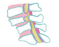 脊柱管狭窄症　解剖図