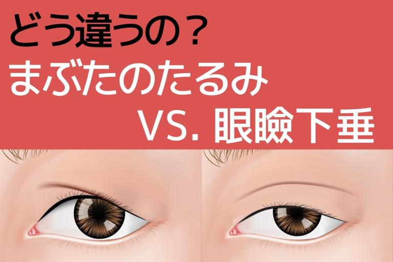まぶたのたるみと眼瞼下垂はどう違う？ 治療に保険はきく？ きかない？
