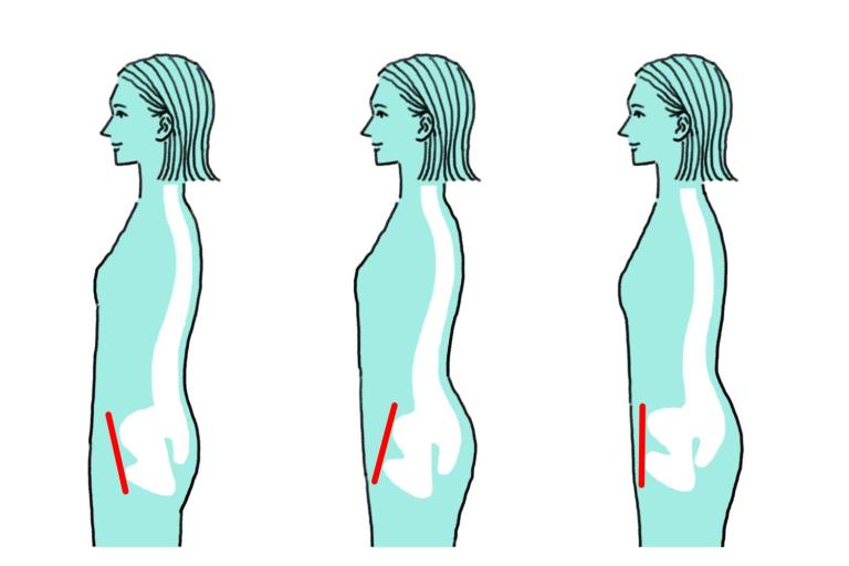 骨盤の歪みを戻すと、血圧＆コレステロール値も下がる!?