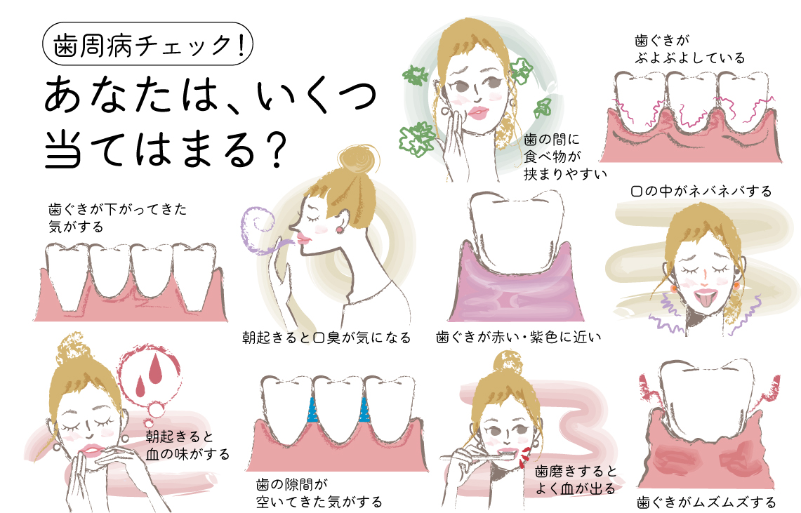 歯周病　セルフチェック　チェックリスト　あなたはいくつ当てはまる