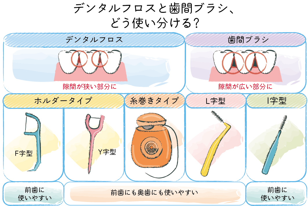 歯周病　歯間ブラシ　デンタルフロス　使い分け　OurAge　