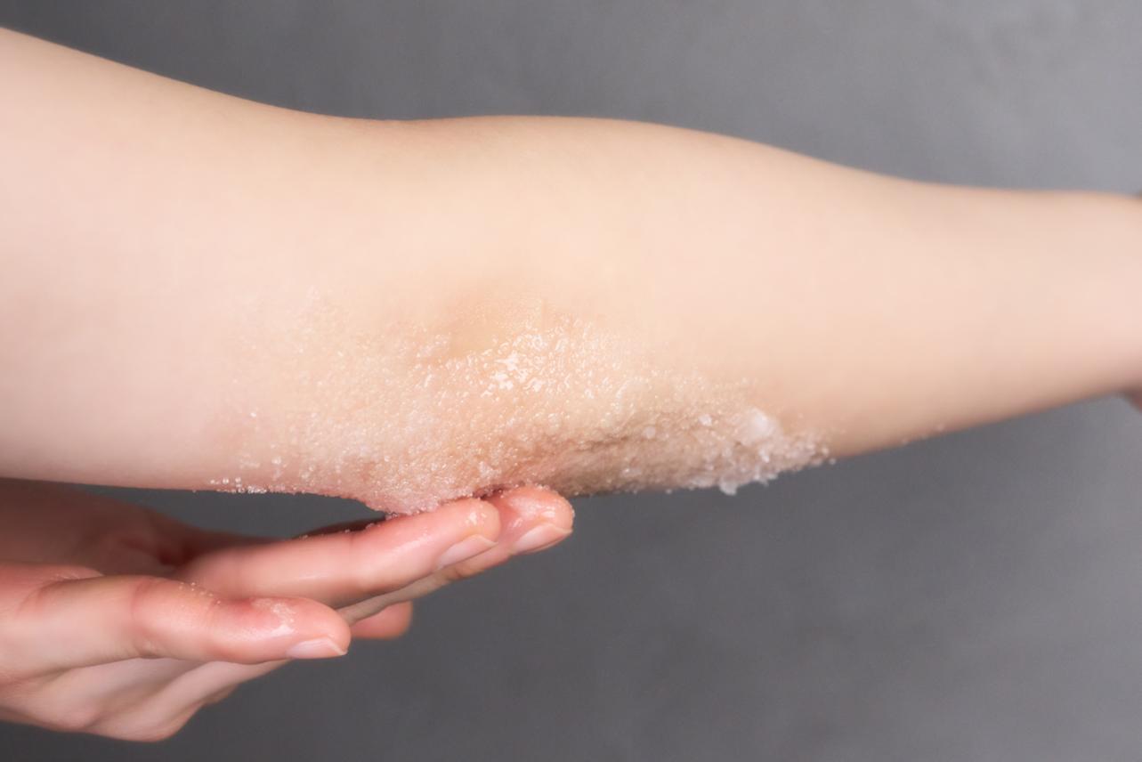 バース　スクラブ　ひじにつけているところ