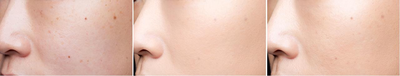 仕上がりイメージ 左から、素肌→塗布後→13 時間経過後