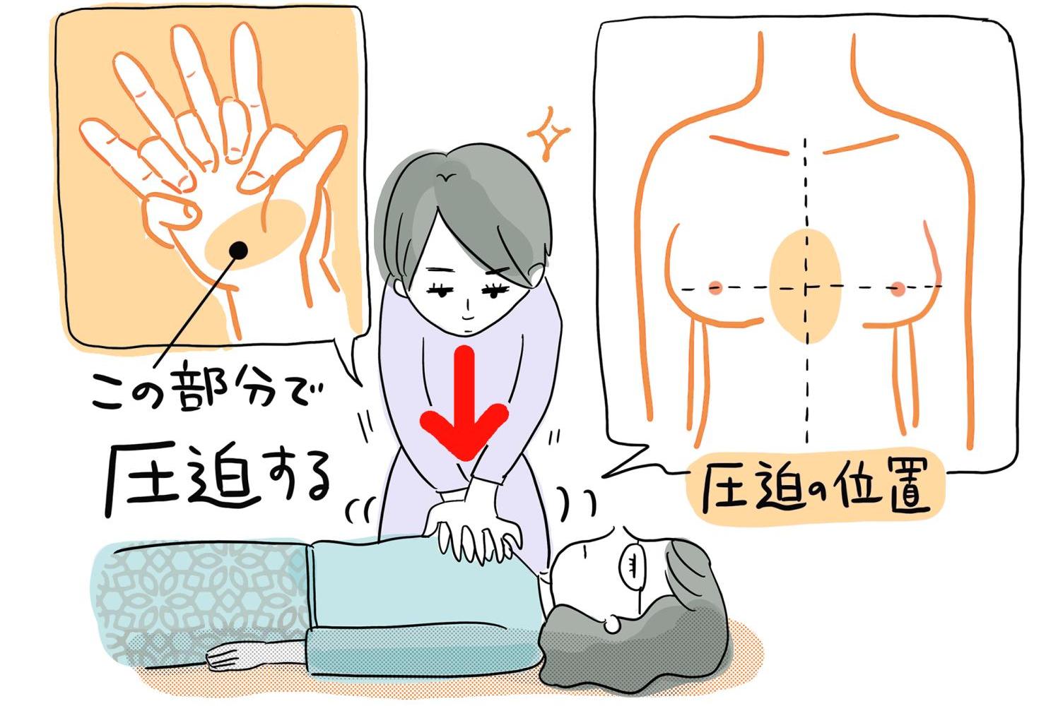 寝たきり　処置方法　心臓マッサージ