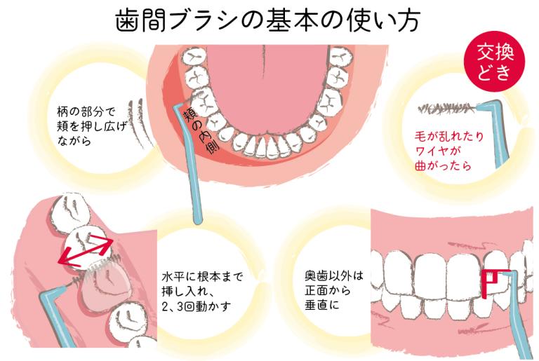 【保存版】歯周病ケアQ＆A　正しいケア用品の選び方、使い方